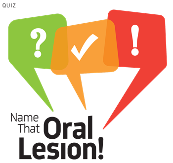  Name that Oral Lesion! Dr. Seena Patel of Southwest Orofacial Group shares several images from case studies and challenges readers to identify what the radiographs reveal.
