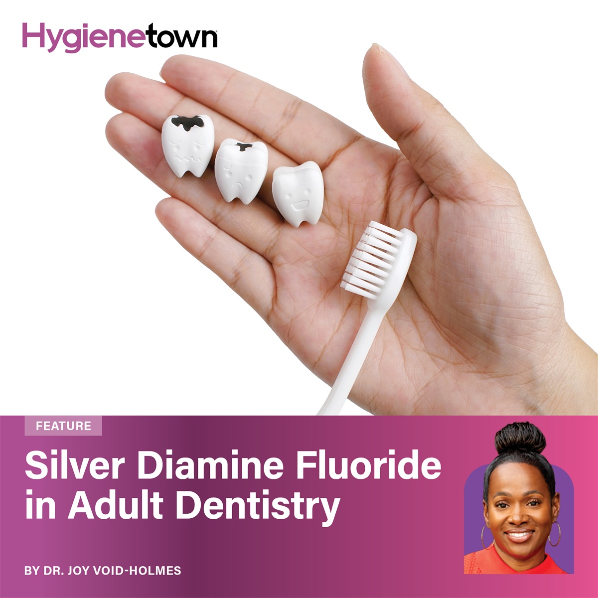 Silver Diamine Fluoride in Adult Dentistry