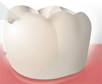 Mineral Rites To prevent caries, tooth enamel needs to stand strong against acidic attacks. Here’s why some patients are likely to need help—and how to proceed